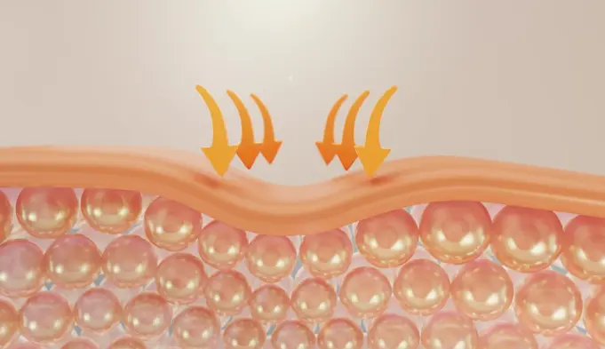 Skin Penetration and Peptide Delivery The Bioavailability Question